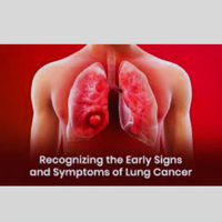 early signs of lung cancer